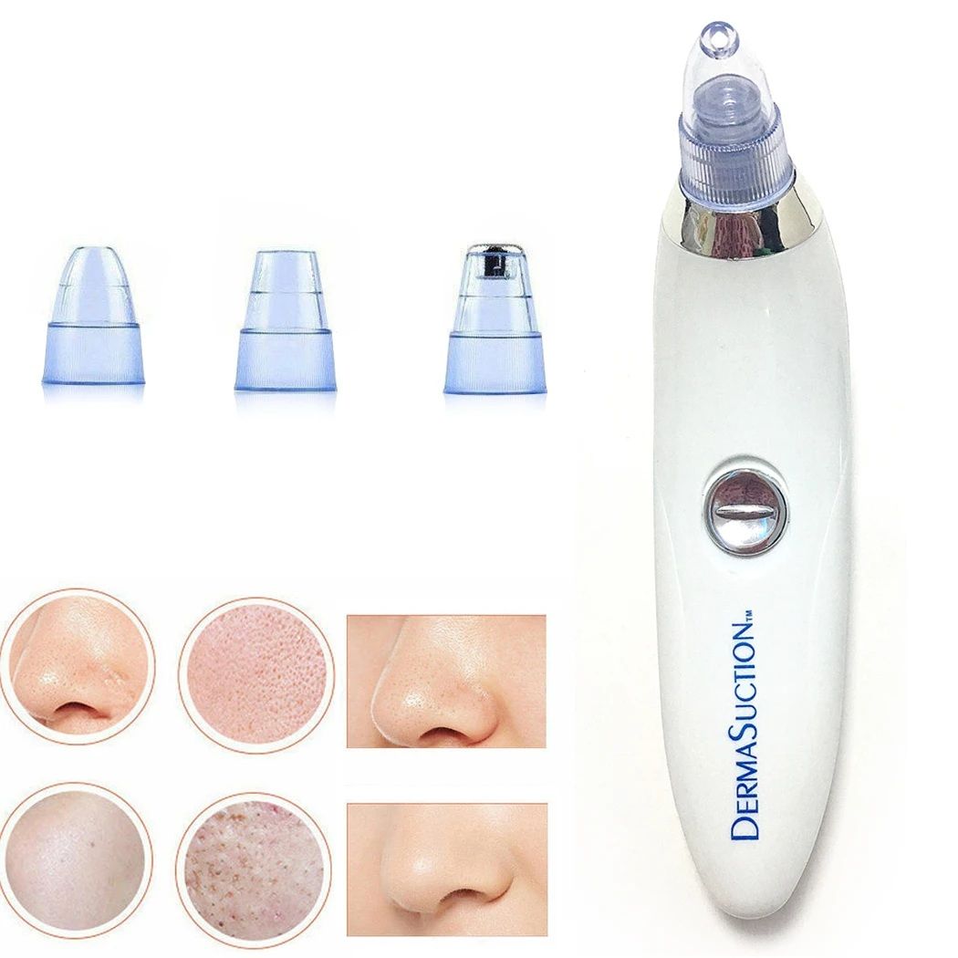 Derma Suction 4-in-1 Blackhead Remover Machine
