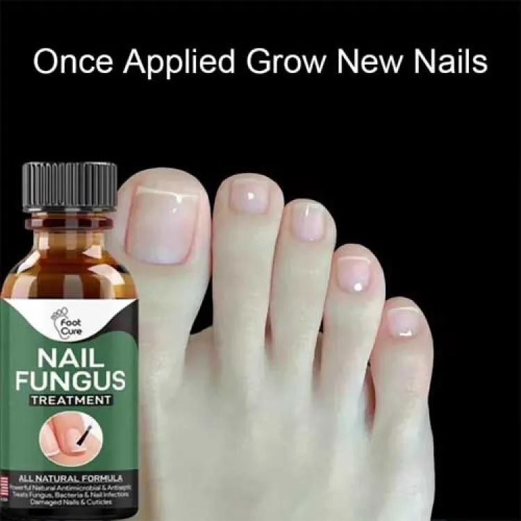 Nail Fungus Treatment Serum – 10ml Anti-Fungal Solution